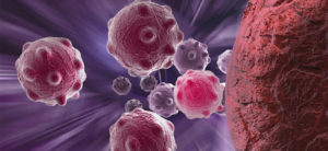 Células cancerígenas. Fuente: lls.org