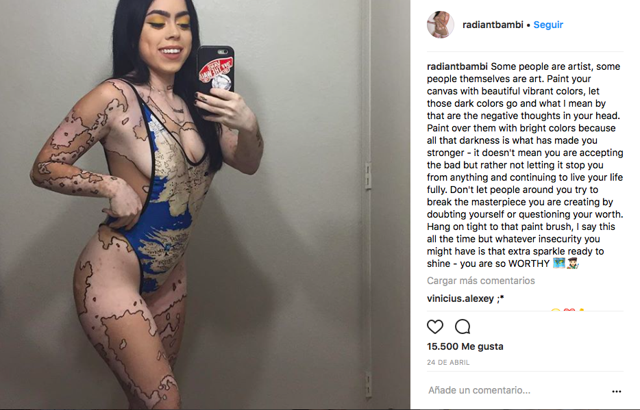 Ash Soto posa en bikini para su cuenta de Instagram. La joven muestra sus manchas, a causa de vitiligo, como una obra de arte.