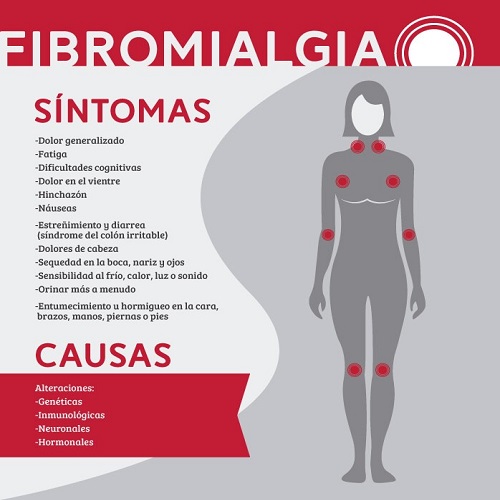 dolor, fibromialgia, ansiedad, tratamiento, cura, medico, medicamentos