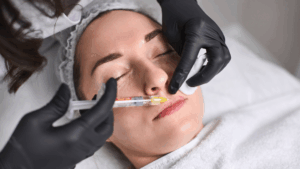 Procedimiento médico de inyección de ácido hialurónico.